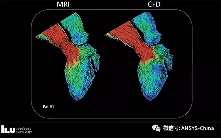 ANSYS 宣布2019年名人堂竞赛优胜者的图6